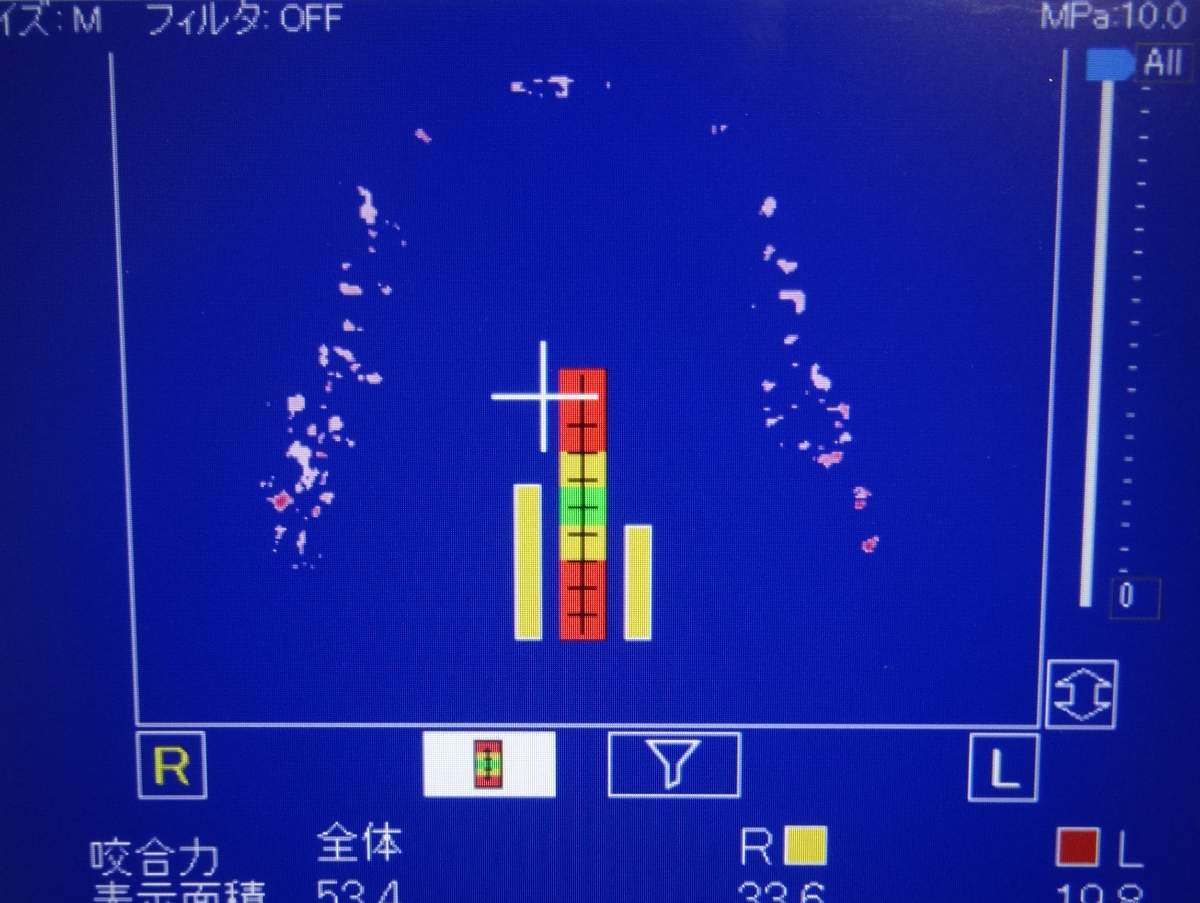 咬合力測定結果の画面表示